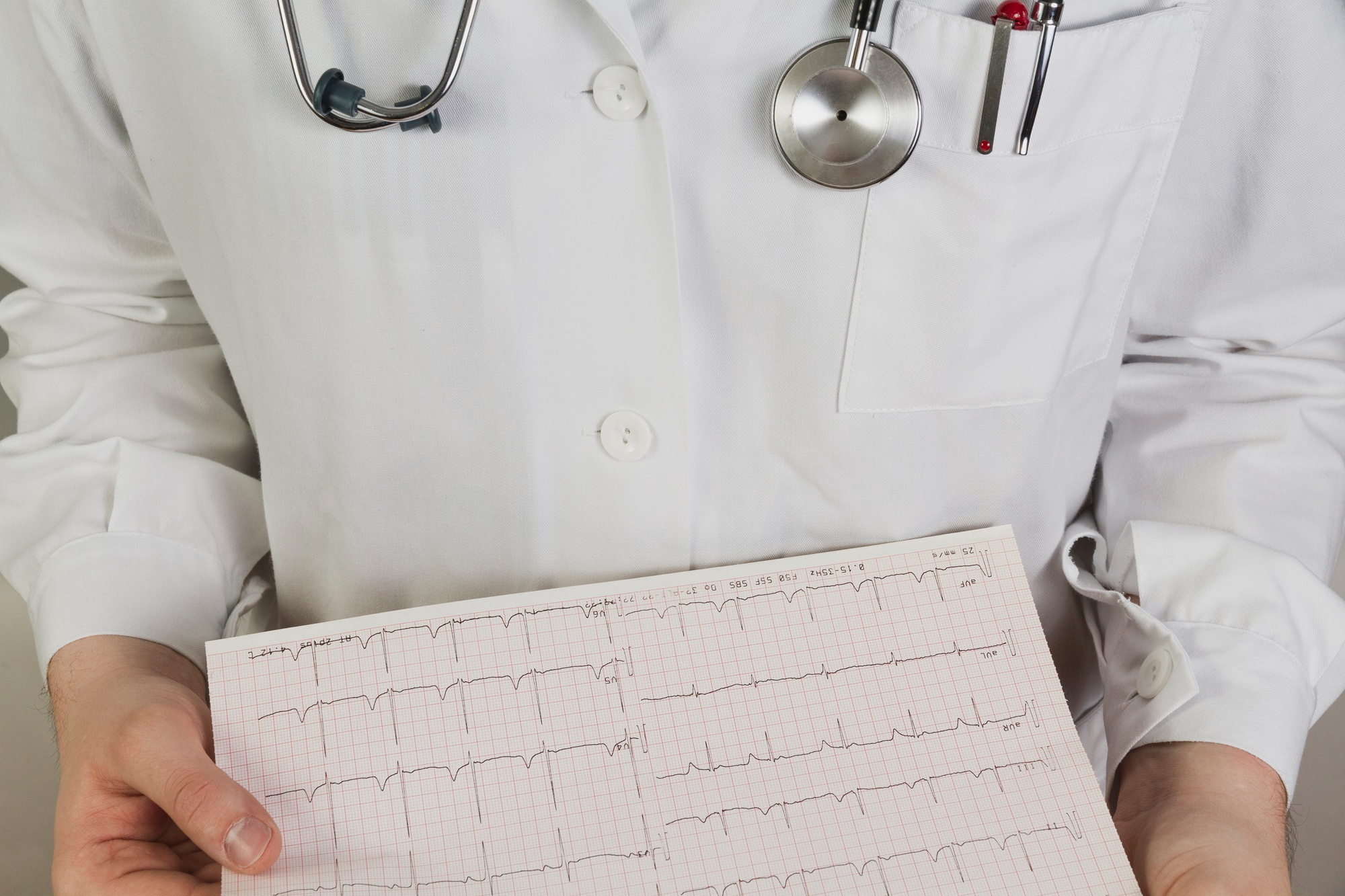 Pericardite: a inflamação no coração que pode simular infarto